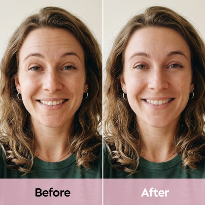 Anti-Wrinkle Facial Patches for Smoother Skin