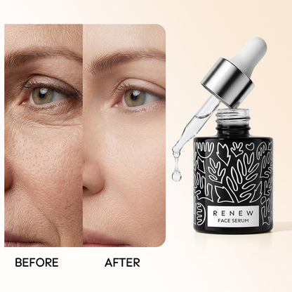 Renew & Hydration Fine Line Smoothing Essence Set
