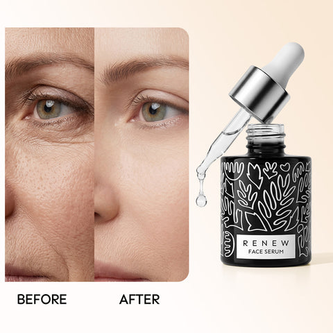Renew & Hydration Fine Line Smoothing Essence Set