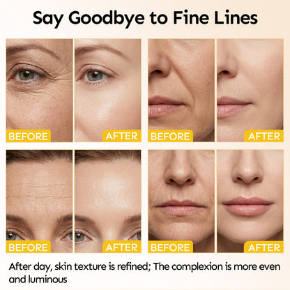 Renew & Hydration Fine Line Smoothing Essence Set