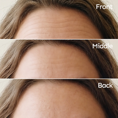 Anti-Wrinkle Facial Patches for Smoother Skin