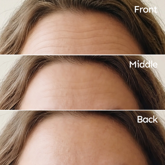 Anti-Wrinkle Facial Patches for Smoother Skin