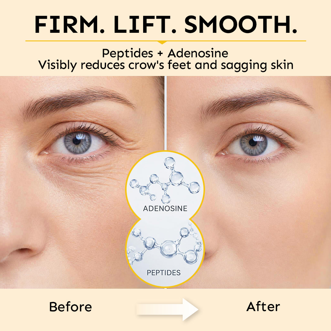 1% Gentle Retinol Bio-Spicule Eye Cream