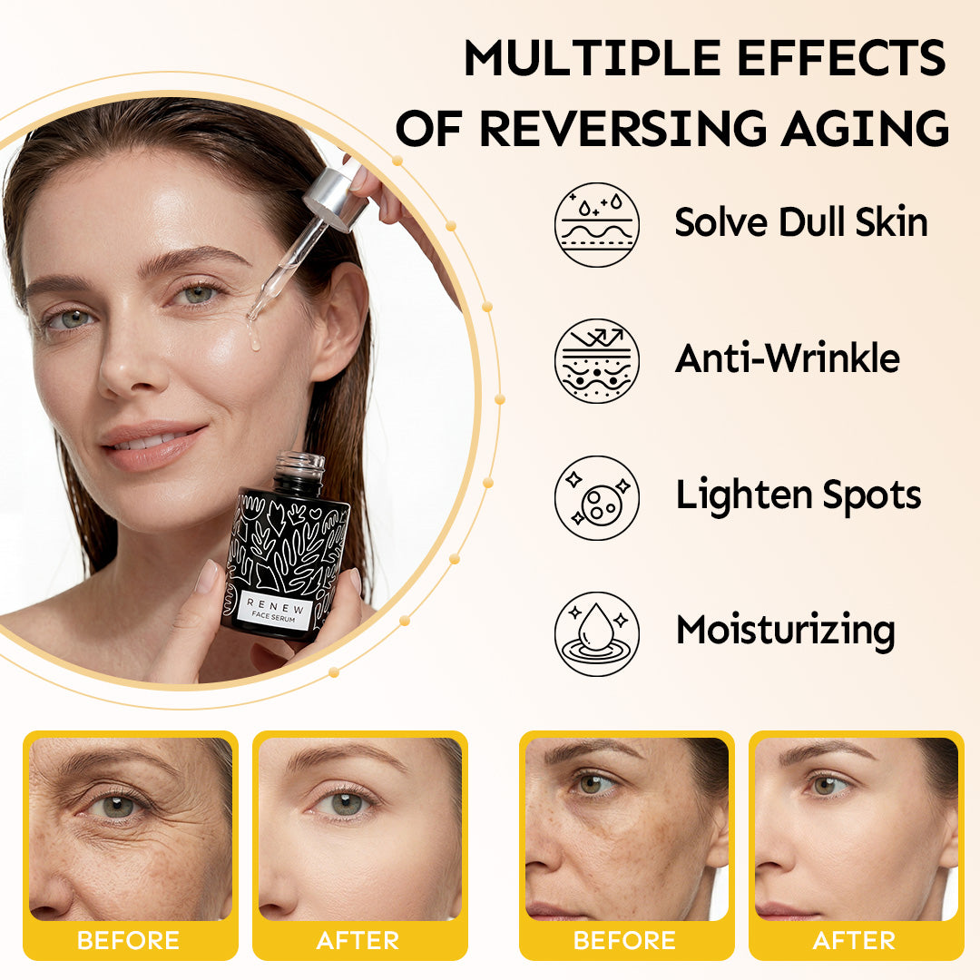 Renew & Hydration Fine Line Smoothing Essence Set