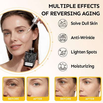 Renew & Hydration Fine Line Smoothing Essence Set