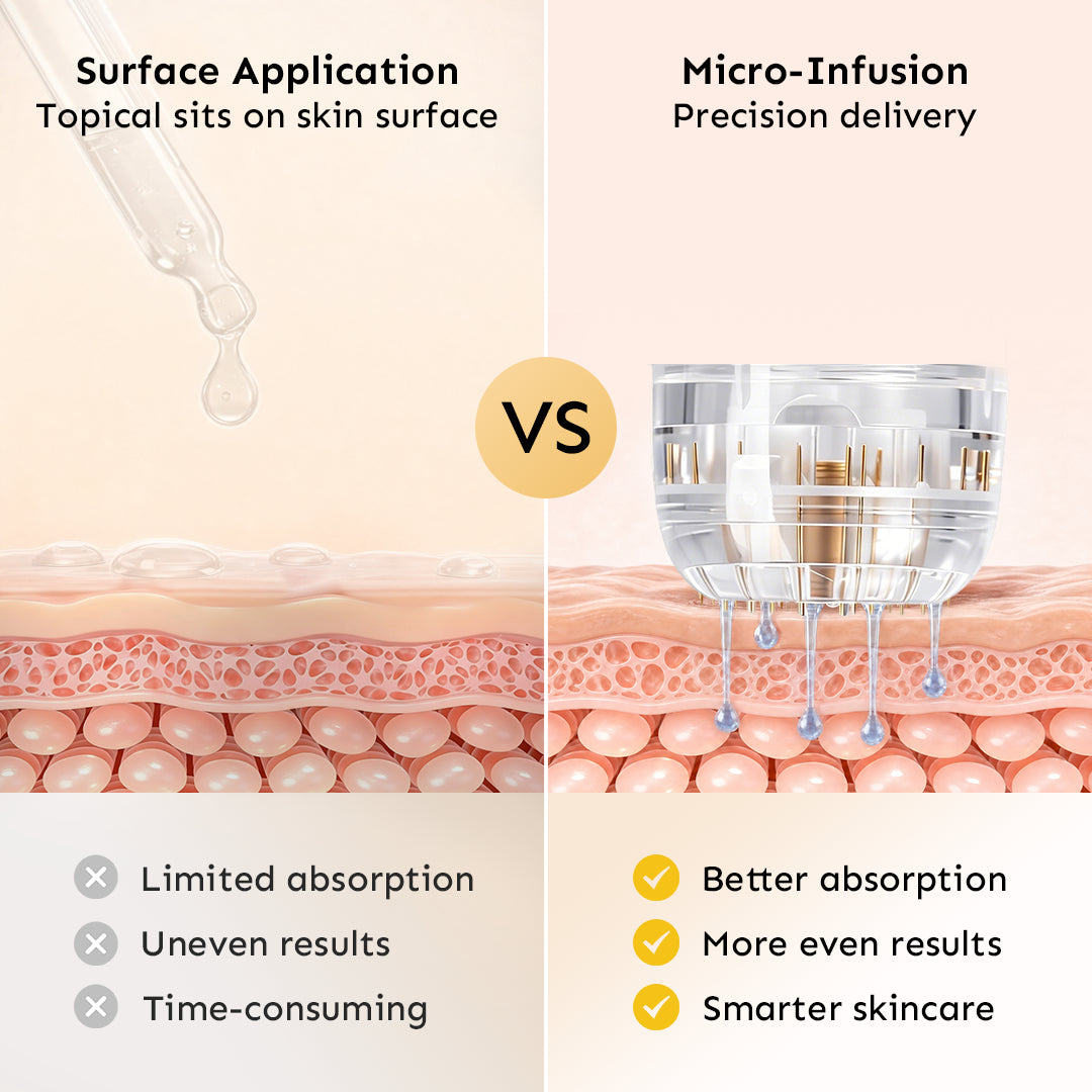Scientific cross-section diagram comparing the limited absorption of topical skin creams to the enhanced precision delivery and better absorption of the microneedling system.